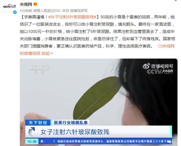 女子注射6針玻尿酸致殘 一針價格1000元