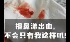 擤鼻涕鼻子經(jīng)常出血是什么原因 每次擤鼻涕都有血是啥毛病