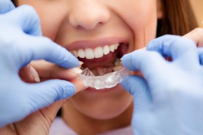 牙齒矯正的費用一般是多少 牙齒矯正大概的費用是多少