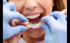 牙齒矯正的費(fèi)用一般是多少 牙齒矯正大概的費(fèi)用是多少