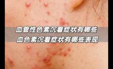 血管性色素沉著癥狀有哪些 血色素沉著癥狀有哪些表現